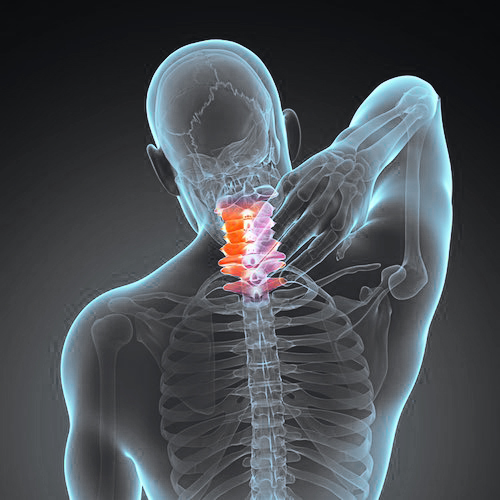 Neck pain